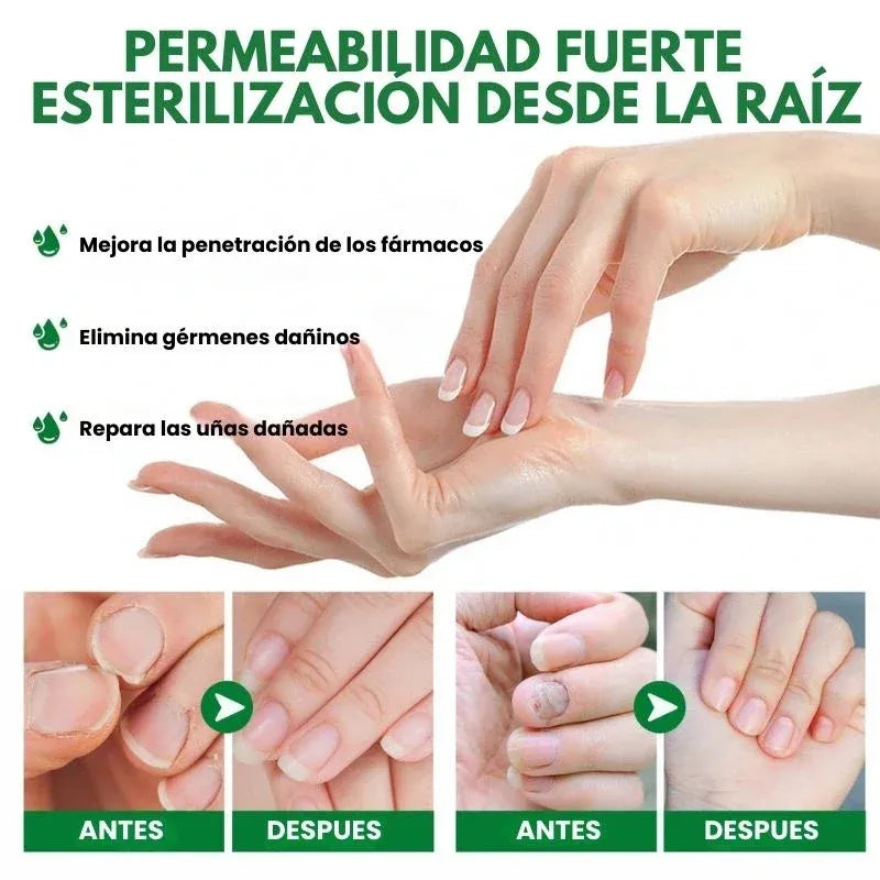 7 DAYS NAILS - Endurecedor de uñas en spray (60ml)